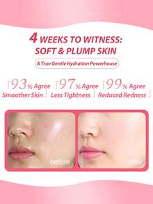 Lancôme Lancome [Mini Size] Soothing Hydrating Hyaluronic Acid Toner, 50ml / Suitable For Dry And Sensitive Skin / Moisturizing And Purifying / Long-Lasting Hydration / Lightweight Texture / Enhances Skin Radiance / This Lightweight Toner Infused With Hyaluronic Acid Can Significantly Hydrate Skin In Just 30 Minutes. The Soothing Hydrating Hyaluronic Acid Toner Helps Strengthen The Skin's Natural Moisturizing Barrier. [Random Packaging (2 Styles)] - New - 50ml - 查看 4