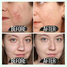 Blackhead Remover Mask, Activated Charcoal Peel Off Face Mask, Blackhead Remover For Oil Skin, Deep Cleansing For Face Nose Blackhead , For All Skin Types