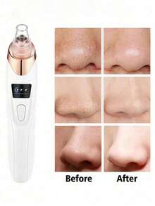 1 Blackhead Remover Pore Vacuum Cleaner, Facial Pore Cleaner, 5 Suction Heads, 3 Suction Forces, Blackhead Remover Pore Vacuum Cleaner USB Rechargeable Facial Pore Cleaner Adult Extraction Tool Multifunctional Cleaning Instructions - Multicolor - View 3