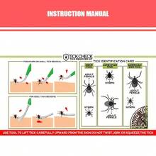 Set de 2 piezas Kit de herramientas para eliminar garrapatas de mascotas - Pinzas antideslizantes de acero inoxidable + Herramienta de doble propósito, Eliminador de pulgas y garrapatas para gatos y perros, Agarre preciso sin dañar el pelaje, Herramienta de eliminación de garrapatas recomendada por veterinarios, Esencial para paseos al aire libre y cuidado de mascotas en el hogar, Suministros duraderos y fáciles de limpiar para el aseo y control de plagas de mascotas