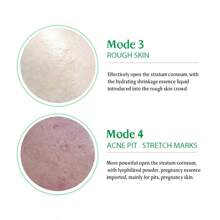 Skin Care Tool Derma Pen Wireless Derma Rolling Pen Digital Display Beauty Machine With 10pcs Replaceable Needle Cartridges - Multicolor - View 9