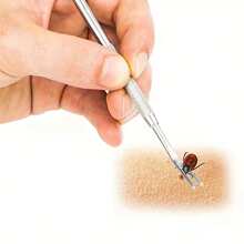 Set de 2 piezas Kit de herramientas para eliminar garrapatas de mascotas - Pinzas antideslizantes de acero inoxidable + Herramienta de doble propósito, Eliminador de pulgas y garrapatas para gatos y perros, Agarre preciso sin dañar el pelaje, Herramienta de eliminación de garrapatas recomendada por veterinarios, Esencial para paseos al aire libre y cuidado de mascotas en el hogar, Suministros duraderos y fáciles de limpiar para el aseo y control de plagas de mascotas