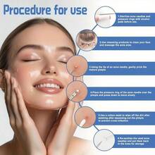 Loại bỏ mụn đầu đen ở mũi, Bộ dụng cụ loại bỏ mụn đầu đen 2025, Dụng cụ nặn mụn chất lượng cao, Nhíp loại bỏ mụn đầu đen có hộp, Dùng để loại bỏ mụn, Phù hợp cho cả nam và nữ. Hộp đựng bộ dụng cụ làm sạch da mặt, Dụng cụ thiết yếu cho việc chăm sóc da và trang điểm, Quà tặng đầu năm học, Quà tặng Giáng sinh. - Nhiều màu - Xem 2