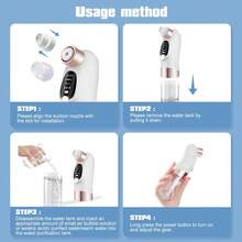 Hailicare New Upgraded Blackhead Remover With Micro-Bubble Design, Angled Tip For Different Skin Types, USB Rechargeable - White - View 11
