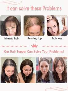 14Inch 18Inch Hair Topper Golden Blonde Hair Toppers For Women Toppers Hair Pieces For Women Hairpieces For Thinning Hair Synthetic Hair Toppers For Women Daily Wear