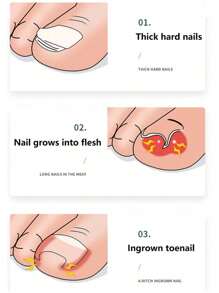قاطع أظافر متعدد الوظائف من الفولاذ المقاوم للصدأ عالي الدقة، تحسين مؤلم للأظافر المتنامية، أداة تقليم الأظافر مناسبة للرجال والنساء، هدية راقية لعيد الهالوين، عيد الميلاد، ، عيد المعلم (البقع السوداء على المقص طبيعية ولا تؤثر على الاستخدام)