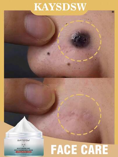 Hyaluronic Acid Moisturizing Facial Cream | Gentle Formula, Suitable For All Skin Types