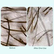 Nutrafol Shampoo, Cleanse And Hydrate Hair And Scalp, Improves Hair Volume, Strength And Texture, Physician-Formulated For Thinning Hair, Sulfate Free - trắng - Xem 6