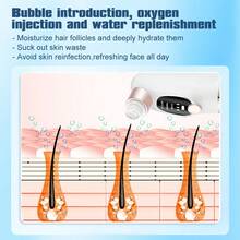 Hailicare New Upgraded Blackhead Remover With Micro-Bubble Design, Angled Tip For Different Skin Types, USB Rechargeable - White - View 8