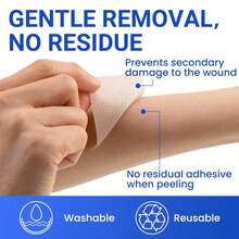 硅胶疤痕贴 医用胶带（1.6英寸×60英寸卷） 面部贴片 剖腹产疤痕贴 亲肤疤痕绷带垫 用于瘢痕疙瘩、拉伸和腹部拉皮手术覆盖