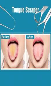 3 PCS Metal Tongue Scraper, Tongue Scrapers For Adults, Stainless Steel Tounge Scrappers, Tounge Scraper, Portable Tongue Scrappers YLYL - 白色 - 查看 4