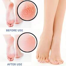 2 Pairs Of Silicone Heel Protectors, Heel Cups, Plantar Protectors, Heel Cushions, Gel Heel Covers For Flats, High Heels And Women's Formal Shoes, Soft Silicone Heel Covers, Cushioning In The Rear Palm, Scratch Resistant Bubble Protection, Comfortable Fit For Dance And Everyday Wear, Shoe Accessories, Insoles. (Skin Color + White)