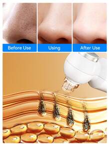 HYUNDAI 六合一电动黑头去除器，带加热功能，便携式USB充电毛孔清洁器，有效清洁面部并去除黑头 - 白色 - 查看 8