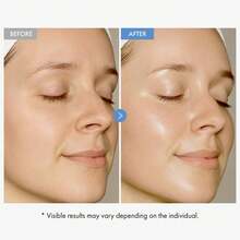 PM Balancing Repair Moisturizer With Niacinamide, Ceramides And Cica, Hydrating Face Moisturizer, Acne Prone Skin And Dry Skin, Non-Comedogenic Night Face Moisturizer, 3 Oz