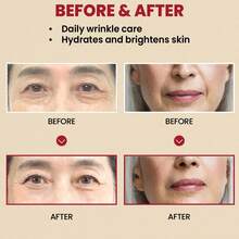 Tinh chất Retinol 2%: Tinh chất Retinol chống lão hóa và giảm nếp nhăn - Chứa 2% Retinol Liposome, Nhân sâm đen, Niacinamide, Pueraria Lobata, Vitamin C và 3 loại Peptide - Sản phẩm chăm sóc da Hàn Quốc, không mùi, 30ml - Nhiều màu - Xem 7