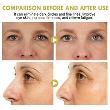 3g [Suitable For Sensitive Skin] Contains Snail Extract, Intensive Care For Dark Circles And Sagging Skin, 24-Hour Close-Fitting Moisturizing, Nighttime Recovery Eye Cream Stick - 3g - View 8