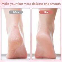 Foot File And Callus Removeressional Pedicure Tools  Dry Call Dead Cracked  Skin Equped Wit 2 Grinding Ea And 1 Cleaning - 白色 - 查看 4