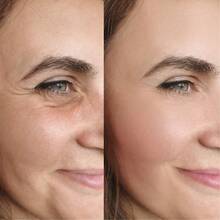 Celimax CELIMAX The Vita-A Retinal Shot Tightening Booster 15ml - 5pc - 查看 6