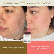 EADEM Cloud Cushion, Face Moisturizer Cream, Skin Care Ultra Repair Cream, Skin Barrier Repair, Hydrating Skincare Cleanser &Amp; Moisturizer With Peptides &Amp; Ceramides, Face Cleanser, 169 Oz - 白色 - 查看 3