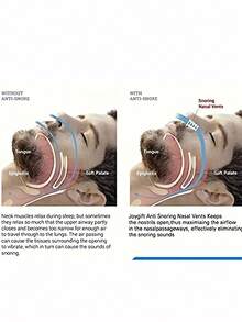 8PCS Adjustable Nose Up Lifter - Clear Nose Lift Clip - Reusable, Unscented, No Battery Needed, Multi-Scenario Use For Beauty Enhancement And Comfort