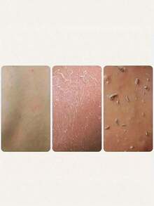 2pcs African Net Exfoliating Bath Towel Set, Double-Sided Design For Gentle/Coarse Exfoliation, Effective Body Scrubbing, Shower Back Scrubber, Quality Mesh Material, Convenient Tie Design, Loofah Bath Towel, Body Sponge, Leaves Skin Smooth, Suitable For Daily Use (Blue, Purple) - Multicolor 2 - View 3