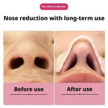 1PC Thermoplastic Nose Splints Secure Nose External Support Protector For Men Women Day And Night Use