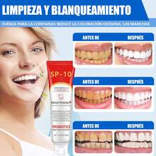 1/2 Pieza Pasta De Dientes Ultra Blanqueadora Sp-10 - Pasta De Dientes Blanqueadora Con Probiótico Fórmula De Limpieza Profunda, Aliento Fresco, Dientes Saludables Pasta Dental Con Clorhexidina, Pasta Dental White, Higiene Personal Pasta Dental Blanqueadora - Rojo y blanco - Ver 4