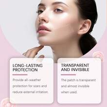 4x150cm Invisible Scar Cover Sheets – Silicone Gel With PET/PU Film, Transparent Adhesive For Day & Night Use - Multicolor - View 4