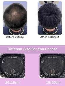 男士假发 - 简单易用，多功能替换系统，短假发延长，发际线脱落，男士自然色 - 自然色&黑色系 - 查看 3