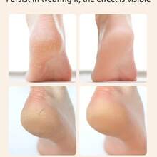 جوارب ساق من السيليكون باللونين الأسود وبلون البشرة، أكمام حماية القدم المرطبة، جوارب ساق مضادة للتشقق للرجال والنساء