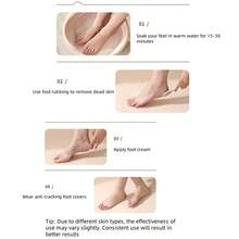 جوارب ساق من السيليكون باللونين الأسود وبلون البشرة، أكمام حماية القدم المرطبة، جوارب ساق مضادة للتشقق للرجال والنساء