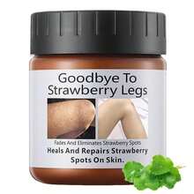 ARCHIDATE Strawberry Leg Cream, Rough And Bumpy Skin Cream, Fade Strawberry Spots, Nourish &Amp; Moisturize Dry Skin, Smoothing &Amp; Buffing Body Scrub Exfoliator - trắng - Xem 1