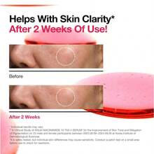 Anuaa NIACINAMIDE 10%+TXA 4% Serum,Un sérum formulado con un 10% de Niacinamida y un 4% de TXA, diseñado para lucir un aspecto más radiante y equilibrado,Gota de suero ligero y acuoso no graso - Rojo - Ver 5