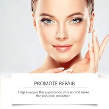 4x150cm Invisible Scar Cover Sheets – Silicone Gel With PET/PU Film, Transparent Adhesive For Day & Night Use - Multicolor - View 3