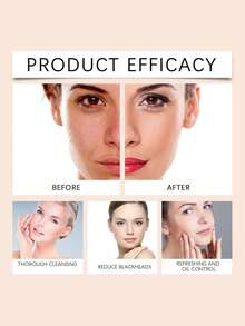 Sữa rửa mặt se khít lỗ chân lông nghệ 100ml, kem làm sạch da mặt với nghệ và axit glycolic, làm sạch dầu thừa, dưỡng ẩm da mà không gây khô căng, giảm mụn đầu đen, cải thiện kết cấu da, làm sáng da, tẩy tế bào chết nhẹ nhàng, mang lại làn da trẻ trung rạng rỡ. - Sữa rửa mặt nghệ se khít lỗ chân lông - Xem 9