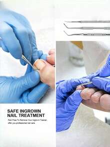 Zestaw 3 narzędzi do pielęgnacji wrastających paznokci u stóp, narzędzia do pedicure dla stóp, w tym podnośnik do paznokci u stóp i pilnik do paznokci u stóp, odpowiedni do leczenia wrastających paznokci u stóp - stal nierdzewna klasy medycznej, narzędzie do czyszczenia paznokci i pedicure, narzędzie do pielęgnacji paznokci u stóp - w zestawie pudełko do przechowywania