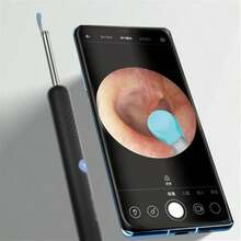 Ear Wax Removal Tool With  Ear Set - Ear Canal Cleaner With 1080P Camera - Ear Cleaning Kit With Scoops - Ear Wax Cleaner With Camera-Ear Pick For IOS & Android - 白色 - 查看 5