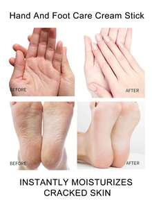 6-In-1 Hand And Foot Care Cream, Containing Turmeric, Vitamin C, Aloe Vera, Vitamin E, Jojoba Seed Oil, 30% Hyaluronic Acid And Other Ingredients, For Foot And Hand Care, Suitable For Dry And Hard Skin, Suitable For Feet, Hands, Knees And Body, Moisturizes Dry Skin - 250g/8.82oz - View 6