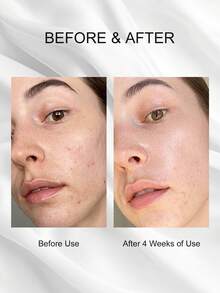 VT COSMETICS CICA Reedle Shot 100 Moisturizing Brightening Pore Refining Essence 50ml - 100 Microneedle Essence--50ml - View 3