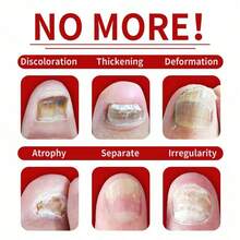 [Local Warehouse Delivery]7Days Nail Care Oil With Ginger, Nail Care Solution Hands & Feet - Moisturizing Dry, Weak & Brittle Nails - Daily Use To Strengthen & Hydrate Nails With Long-Lasting Shine, Gentle Formula Clean & Healthy Nails 1. 01oz Per Piece