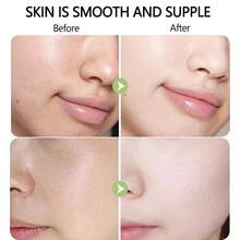 Milk Facial Toner, Gently Nourishes And Soothes Dry, Reddened Skin, Improves Dullness And Uneven Skin Tone, Hydrates And Moisturizes, Brightens Complexion And Softens Skin