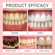 牙齿亮白牙膏，用于清洁牙齿污渍和黄牙，含有温和成分，呵护口腔健康