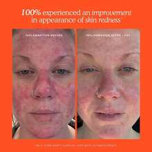 Mini SOS Daily Rescue Facial Spray With Hypochlorous Acid