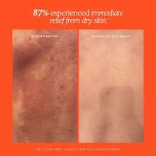 Mini SOS Daily Rescue Facial Spray With Hypochlorous Acid