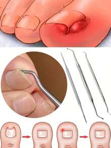 3PCS Stainless Steel Ingrown Toenail Tool Kit - Double Sided Pedicure Nail File, Lifter, Spoon, And Pusher For Cleaning And Removing Ingrown Toenails,Bag,Organizer,Storage