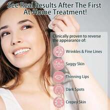 Micro Infusion For Skin Care,Micro Infusions System For Taking Care Of Blemished Skin For All Types (6+2) - trắng - Xem 4