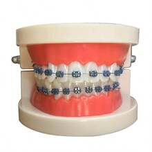 口腔金属托槽模型，诊所病人沟通展示牙科模型，牙科牙齿托槽模型