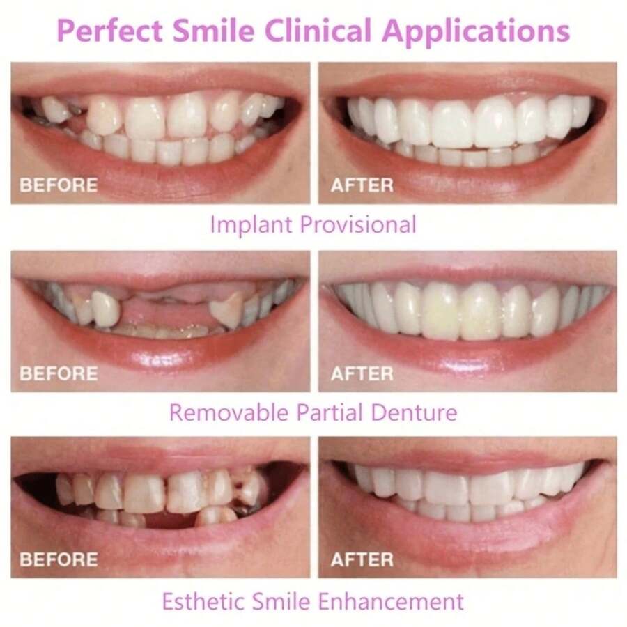 4pcs/Set Teeth Whitening Braces, Soft Adjustable Comfortable Fit, Convenient Cleaning, Restore Natural Smile, Suitable For Men And Women, Exquisite Gift