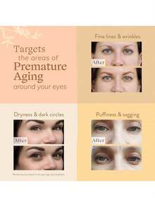 1Pc KOREA SEOUL1988 SERUM:RETINAL LIPOSOME 2%+BLACK GINSENG. Hydrates And Replenishes Moisture, Eliminates Signs Of Fatigue, Prevents Dryness, Brightens Skin Tone, Hydrates, Brightens, Deeply Moisturizes, Improves Elasticity, Smoothes Skin, Makes Skin Radiant, Improves Hydration, Repairs Isolation, Moisturizes And Controls Oil - Multicolor - View 3