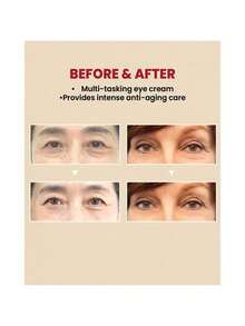 1Pc KOREA SEOUL1988 SERUM:RETINAL LIPOSOME 2%+BLACK GINSENG. Hydrates And Replenishes Moisture, Eliminates Signs Of Fatigue, Prevents Dryness, Brightens Skin Tone, Hydrates, Brightens, Deeply Moisturizes, Improves Elasticity, Smoothes Skin, Makes Skin Radiant, Improves Hydration, Repairs Isolation, Moisturizes And Controls Oil - Multicolor - View 5